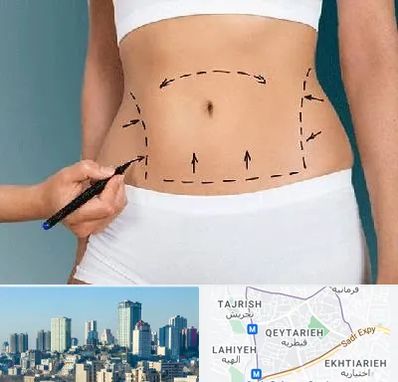 دکتر طب سنتی برای لاغری در قیطریه 