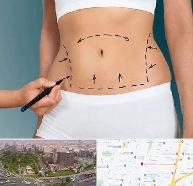 دکتر طب سنتی برای لاغری در آیت الله کاشانی