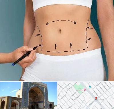 دکتر طب سنتی برای لاغری در مصلی مشهد 