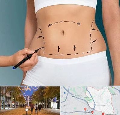 دکتر طب سنتی برای لاغری در ولیعصر ارومیه 