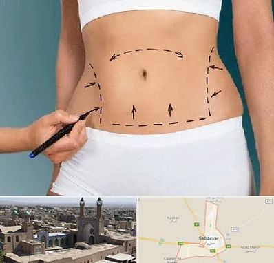 دکتر طب سنتی برای لاغری در سبزوار