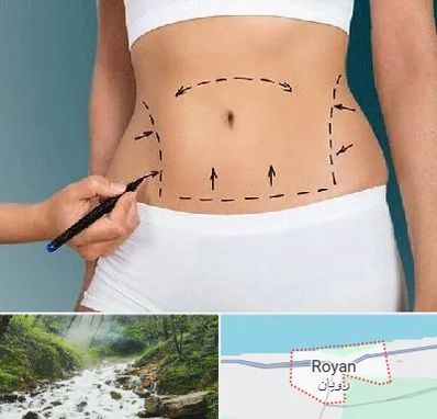 دکتر طب سنتی برای لاغری در رویان