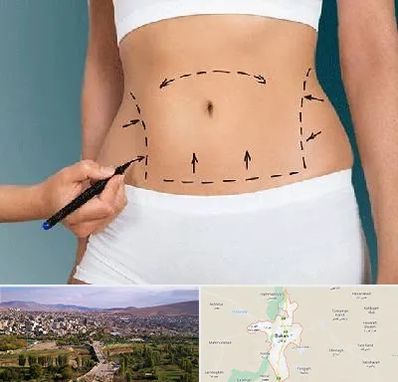 دکتر طب سنتی برای لاغری در بوکان