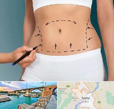 دکتر طب سنتی برای لاغری در دزفول