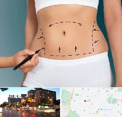 دکتر طب سنتی برای لاغری در بلوار سجاد مشهد 