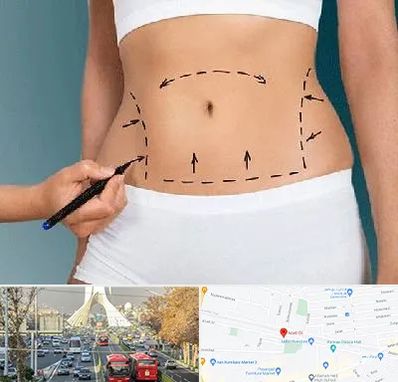 دکتر طب سنتی برای لاغری در خیابان آزادی 