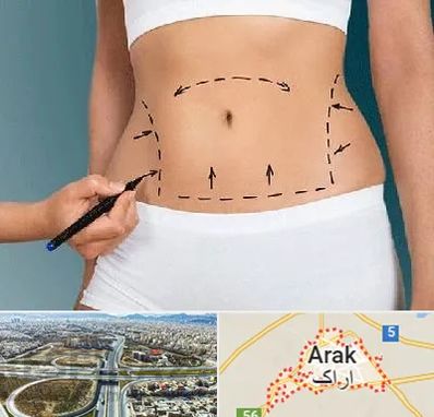 دکتر طب سنتی برای لاغری در اراک