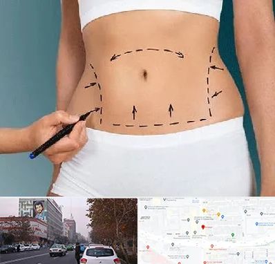 دکتر طب سنتی برای لاغری در کارگر شمالی 