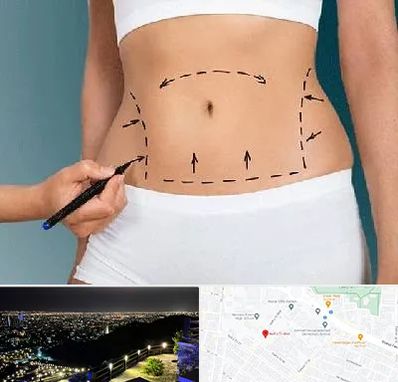 دکتر طب سنتی برای لاغری در هفت تیر مشهد 