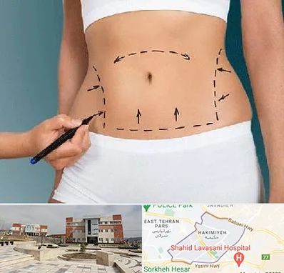 دکتر طب سنتی برای لاغری در حکیمیه