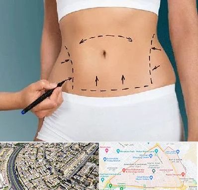 دکتر طب سنتی برای لاغری در شهرک غرب مشهد 