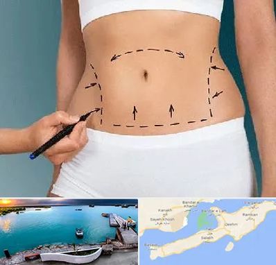 دکتر طب سنتی برای لاغری در قشم