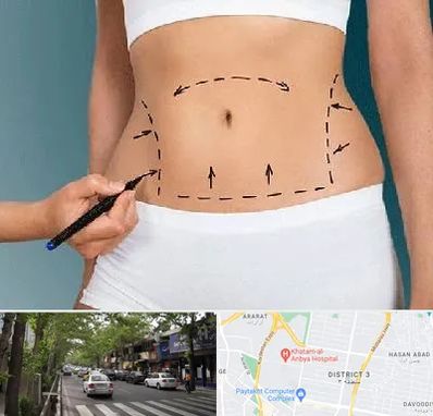 دکتر طب سنتی برای لاغری در ظفر 