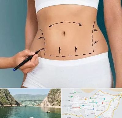 دکتر طب سنتی برای لاغری در ایلام