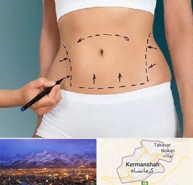 دکتر طب سنتی برای لاغری در کرمانشاه