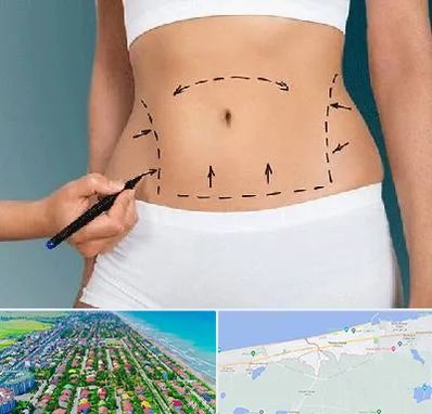 دکتر طب سنتی برای لاغری در فریدونکنار