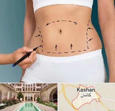 دکتر طب سنتی برای لاغری در کاشان