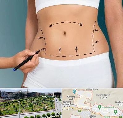 دکتر طب سنتی برای لاغری در پردیس