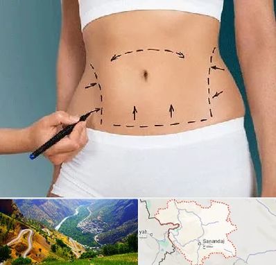 دکتر طب سنتی برای لاغری در کردستان