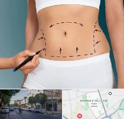 دکتر طب سنتی برای لاغری در شهرک ولیعصر