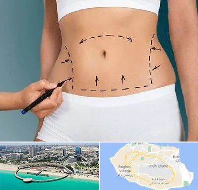 دکتر طب سنتی برای لاغری در کیش