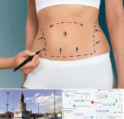 دکتر طب سنتی برای لاغری در کارگر جنوبی 