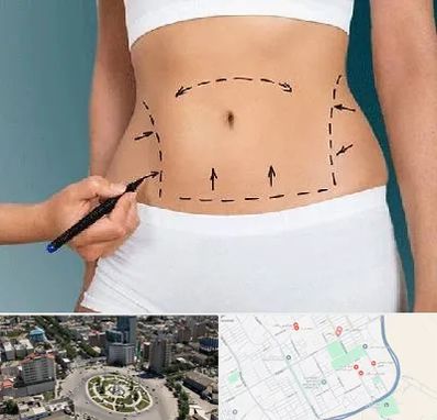 دکتر طب سنتی برای لاغری در زرافشان اسلامشهر 