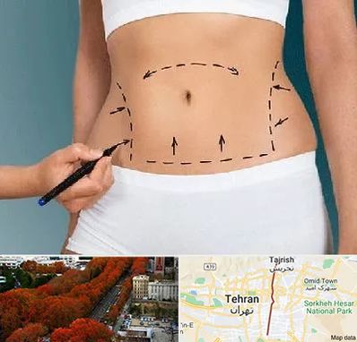 دکتر طب سنتی برای لاغری در ولیعصر 