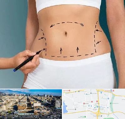 دکتر طب سنتی برای لاغری در شهرک راه آهن 