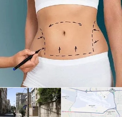 دکتر طب سنتی برای لاغری در مهرآباد