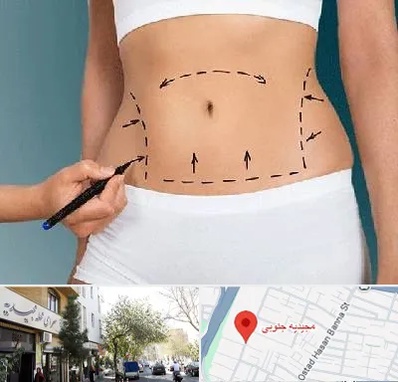 دکتر طب سنتی برای لاغری در مجیدیه جنوبی