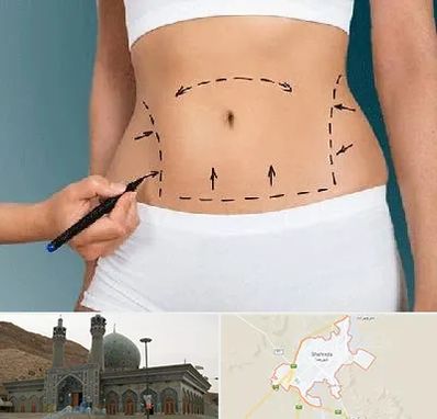 دکتر طب سنتی برای لاغری در شهرضا