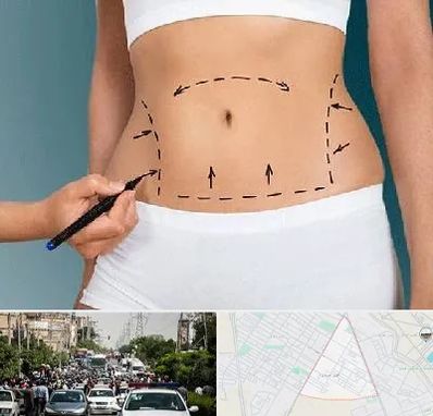 دکتر طب سنتی برای لاغری در سیدی مشهد 