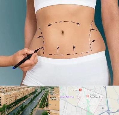 دکتر طب سنتی برای لاغری در فاز سه اندیشه
