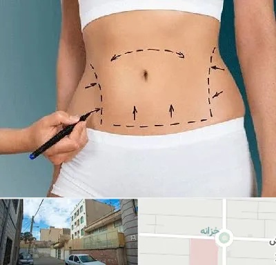 دکتر طب سنتی برای لاغری در خزانه