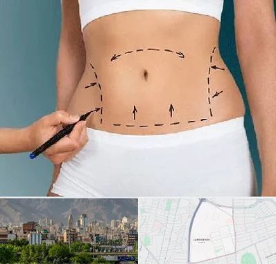 دکتر طب سنتی برای لاغری در جمشیدیه