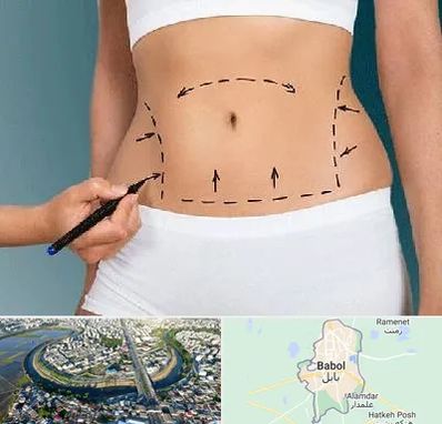 دکتر طب سنتی برای لاغری در بابل