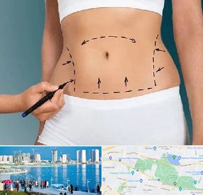 دکتر طب سنتی برای لاغری در چیتگر 