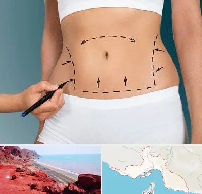 دکتر طب سنتی برای لاغری در هرمزگان