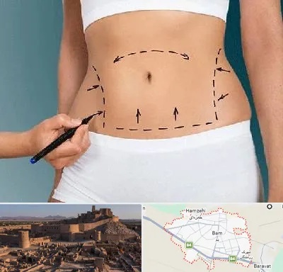دکتر طب سنتی برای لاغری در بم