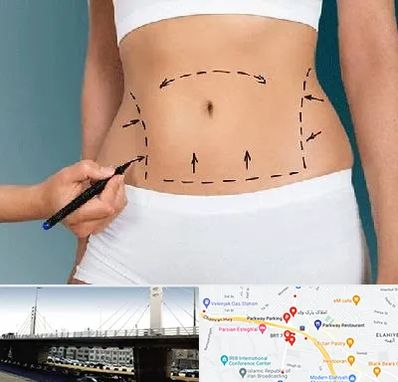 دکتر طب سنتی برای لاغری در پارک وی 