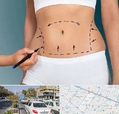 دکتر طب سنتی برای لاغری در مفتح مشهد 