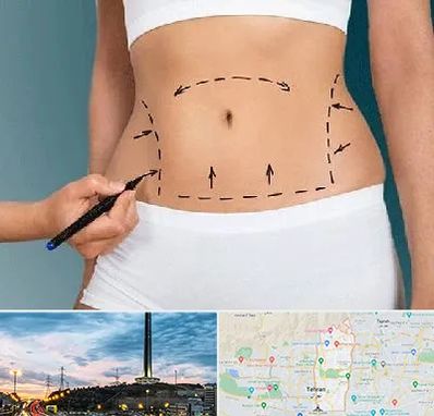 دکتر طب سنتی برای لاغری در منطقه 2 تهران 