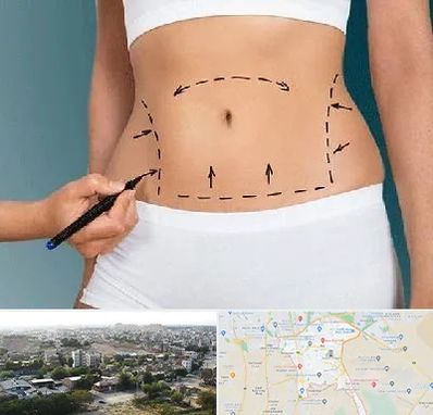 دکتر طب سنتی برای لاغری در منطقه 20 تهران 