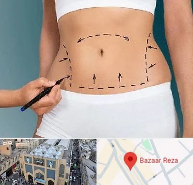 دکتر طب سنتی برای لاغری در بازار رضا مشهد
