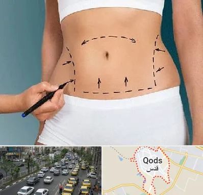 دکتر طب سنتی برای لاغری در شهر قدس