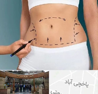 دکتر طب سنتی برای لاغری در یاخچی آباد