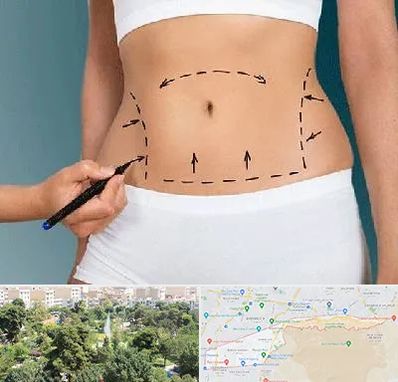 دکتر طب سنتی برای لاغری در منطقه 13 تهران 