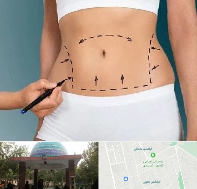 دکتر طب سنتی برای لاغری در کیانشهر