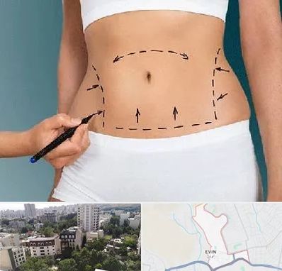 دکتر طب سنتی برای لاغری در اوین